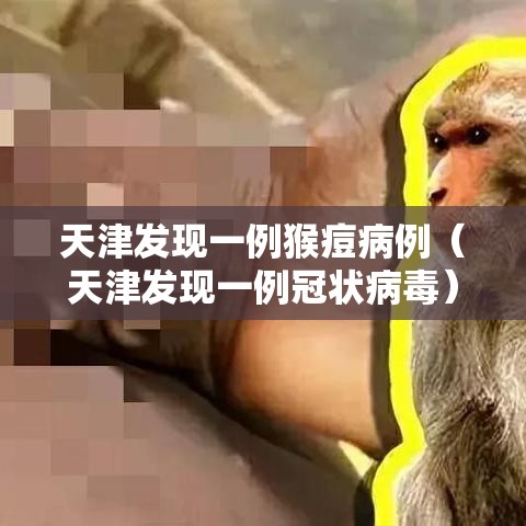 天津发现一例猴痘病例（天津发现一例冠状病毒）