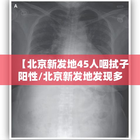【北京新发地45人咽拭子阳性/北京新发地发现多少病例】