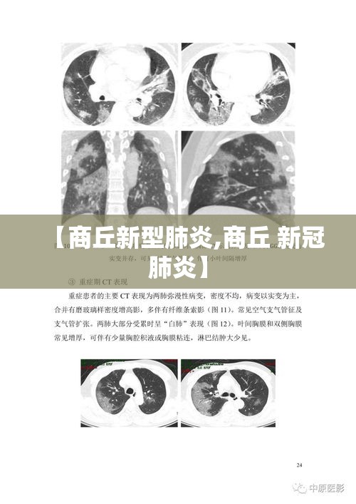 【商丘新型肺炎,商丘 新冠肺炎】