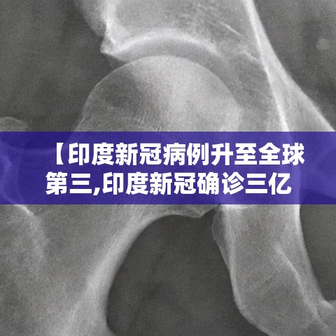 【印度新冠病例升至全球第三,印度新冠确诊三亿】