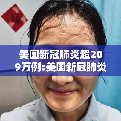 美国新冠肺炎超209万例:美国新冠肺炎超2716万例