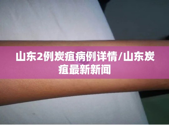 山东2例炭疽病例详情/山东炭疽最新新闻