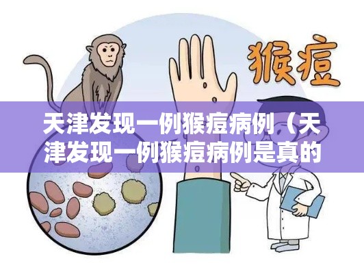 天津发现一例猴痘病例（天津发现一例猴痘病例是真的吗）