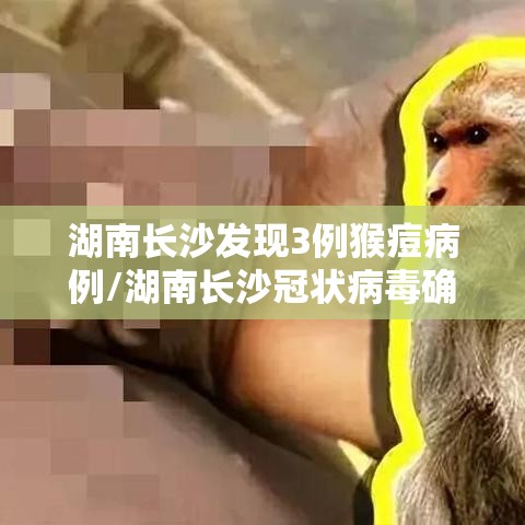 湖南长沙发现3例猴痘病例/湖南长沙冠状病毒确诊