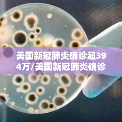 美国新冠肺炎确诊超394万/美国新冠肺炎确诊超394万人感染