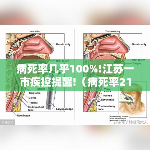 病死率几乎100%!江苏一市疾控提醒!（病死率21%）