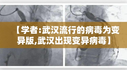 【学者:武汉流行的病毒为变异版,武汉出现变异病毒】