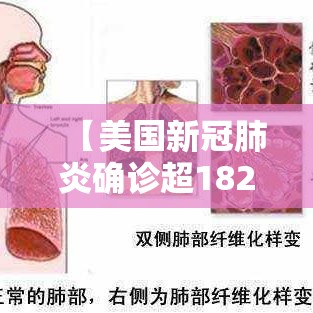 【美国新冠肺炎确诊超182万,美国新冠肺炎确诊超507万例】