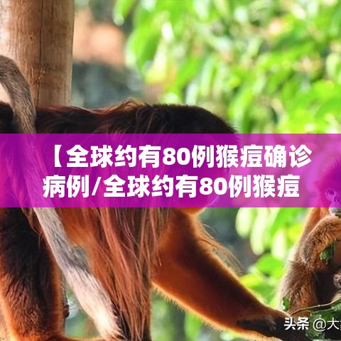 【全球约有80例猴痘确诊病例/全球约有80例猴痘确诊病例多少】 【全球约有80例猴痘确诊病例/全球约有80例猴痘确诊病例多少】