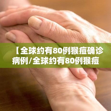 【全球约有80例猴痘确诊病例/全球约有80例猴痘确诊病例多少】 【全球约有80例猴痘确诊病例/全球约有80例猴痘确诊病例多少】