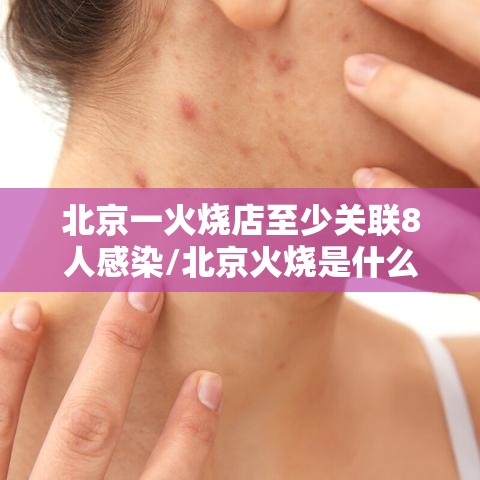 北京一火烧店至少关联8人感染/北京火烧是什么东西