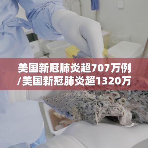 美国新冠肺炎超707万例/美国新冠肺炎超1320万例