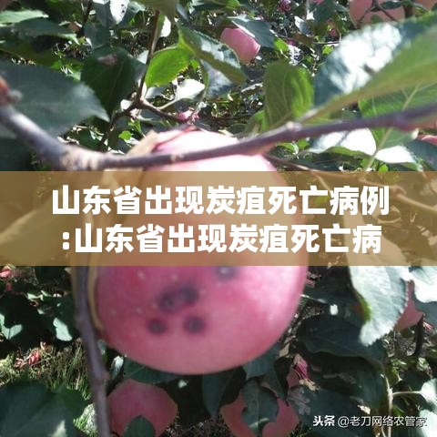 山东省出现炭疽死亡病例:山东省出现炭疽死亡病例多少