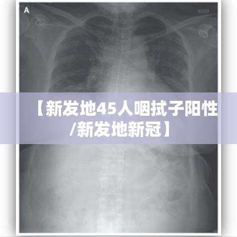【新发地45人咽拭子阳性/新发地新冠】